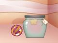 Spel Soet treffer aanlyn