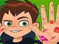Spel Ben10 Hand Dokter  aanlyn