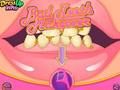 Spel Slegte tande makeover  aanlyn