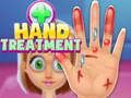 Spel Hand Behandeling  aanlyn