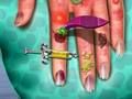 Spel Hand Vel Dokter  aanlyn