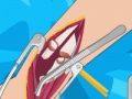 Spel Armchirurgie 2 aanlyn Spel Armchirurgie 2 aanlyn