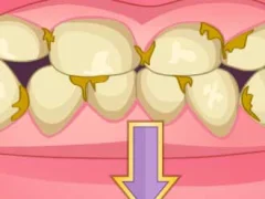 Spel Bad Teeth Makeover aanlyn