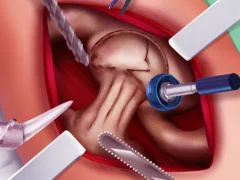 Spel Princess Hips Surgery aanlyn