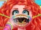 Spel Treating stuck fish bone aanlyn
