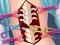 Spel Anna Scoliosis Surgery aanlyn