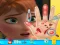 Spel Anna hand doctor aanlyn