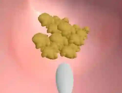 Spel Earwax Clinic aanlyn