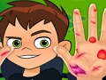 Spel Ben10 Hand Dokter  aanlyn