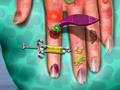 Spel Hand Vel Dokter  aanlyn
